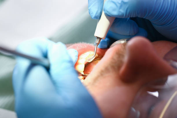 Best Emergency TMJ Treatment in Twain Harte, CA