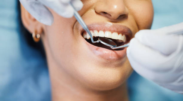 Best Emergency Treatment for Dental Infections or Abscesses in Twain Harte, CA